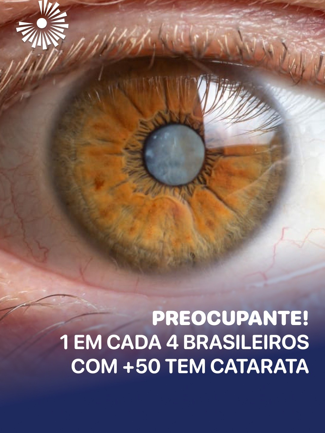 Post: TU SABIAS? 👁️😬

A visão também muda com …